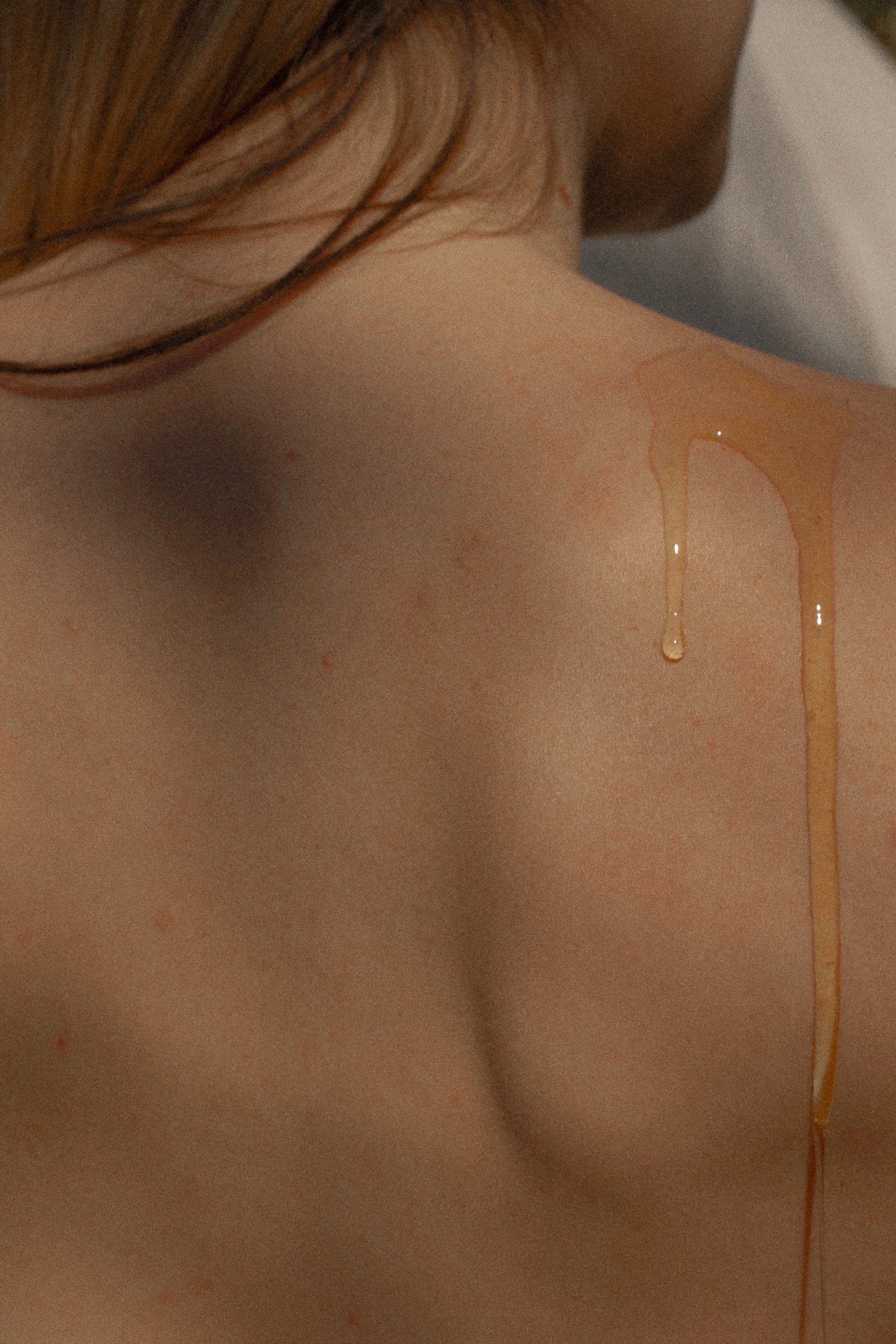 How to Choose the Right Products for Oily and Acne-Prone Skin
